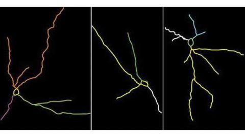 Researchers find new signs of stress damage in the brain, plus hope for prevention
