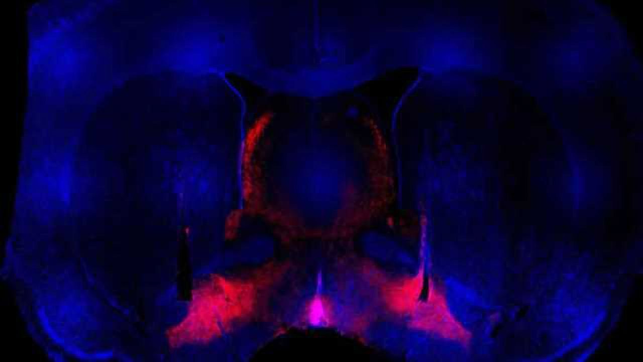 Researchers find what could be brain's trigger for binge behavior