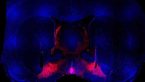Researchers find what could be brain's trigger for binge behavior