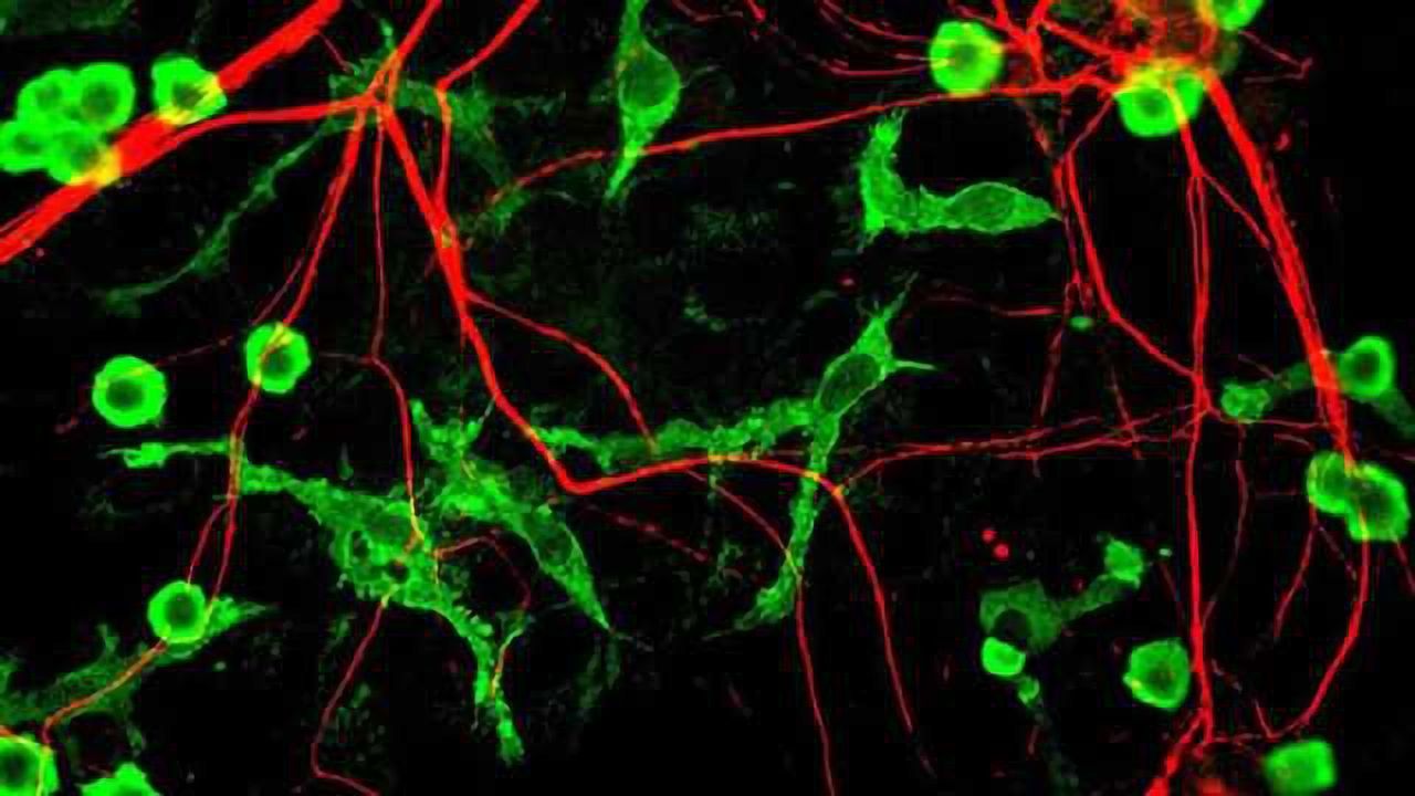 The brain needs to 'clean itself up' so that it can 'sort itself out'