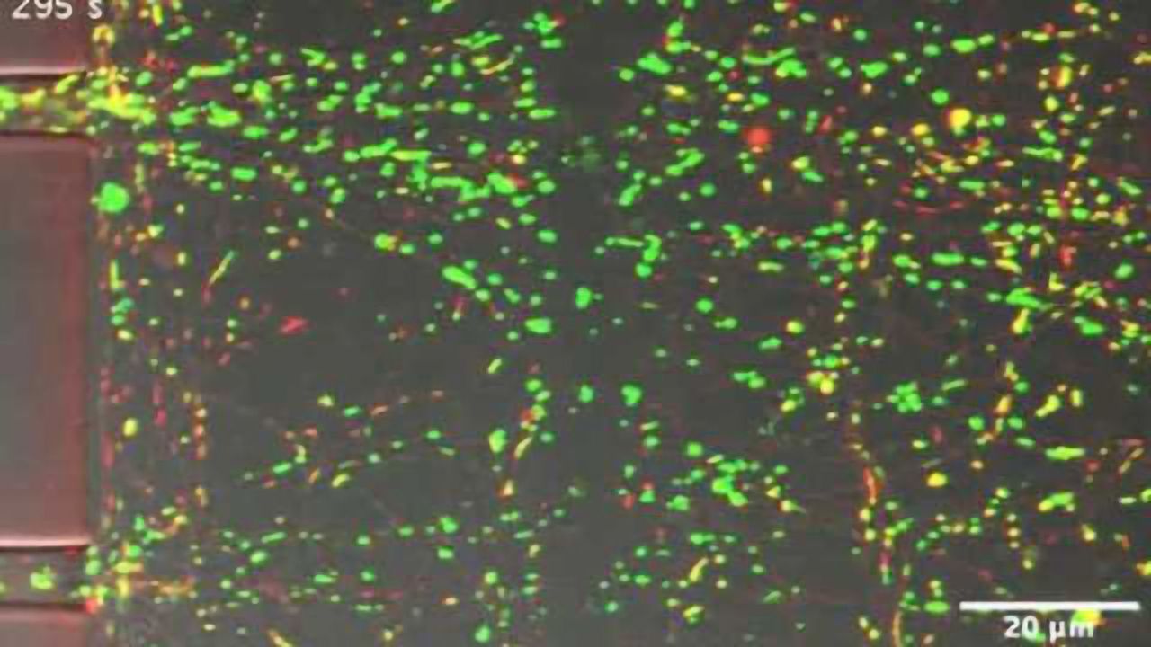 Mobilizing mitochondria may be key to regenerating damaged neurons