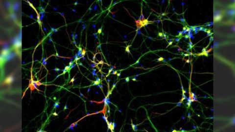 Brain power: Gene critical for human brain development identified