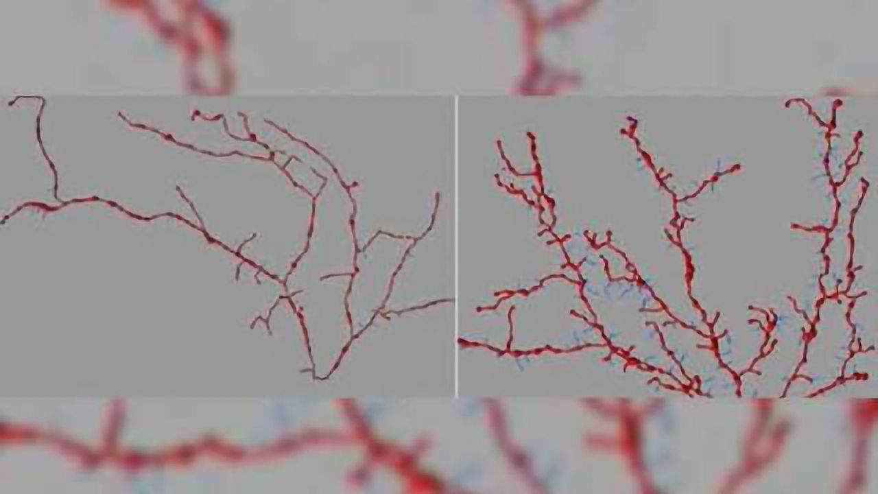 Novel mouse model sheds new light on autism spectrum disorder