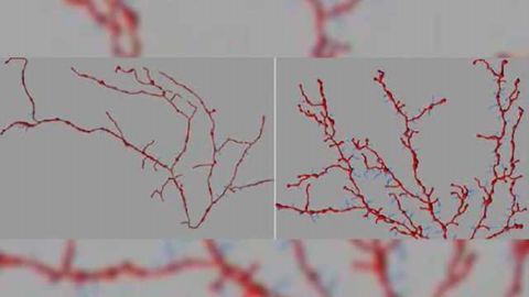 Novel mouse model sheds new light on autism spectrum disorder