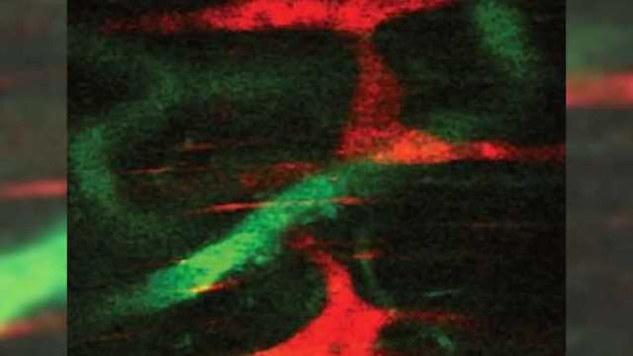 A window to the gut's brain: Real-time view of enteric nervous system provides new way to study gastrointestinal disorders