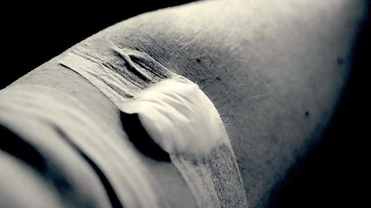 Researchers develop blood test that detects early Alzheimer's disease
