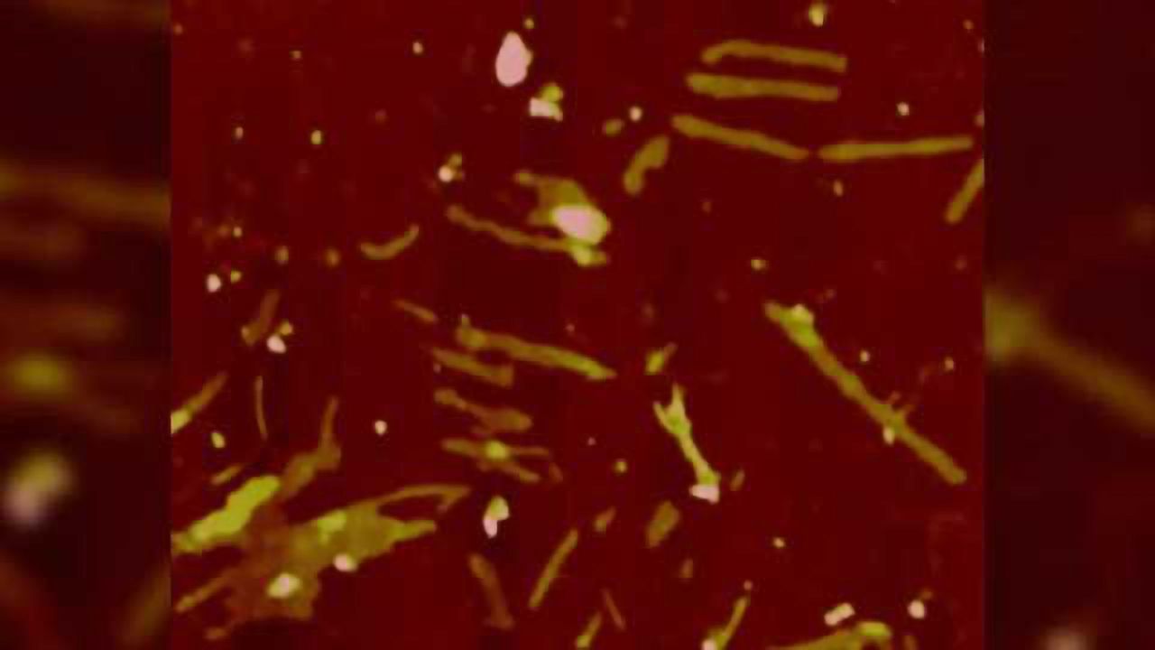 Discovery of molecular protection linked to a degenerative neuromuscular disease