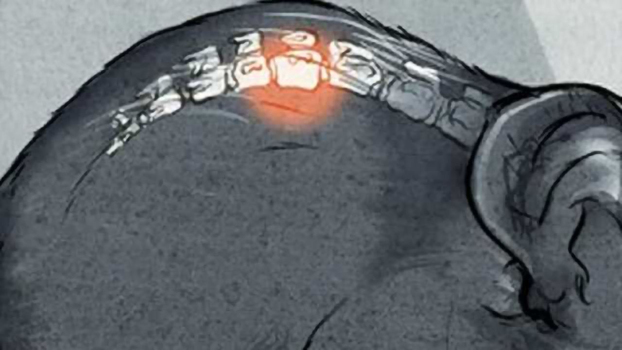 Researchers find stroke damages blood-spinal cord barrier
