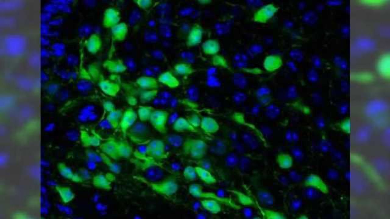 New insights uncovered into Prader-Willi syndrome