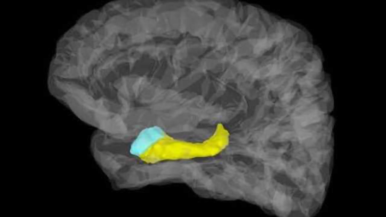 First direct evidence for ultra-fast responses in human amygdala to fear
