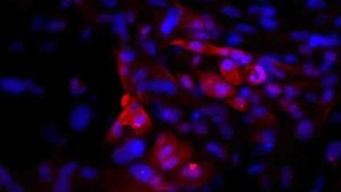 Pituitary tissue grown from human stem cells releases hormones in rats