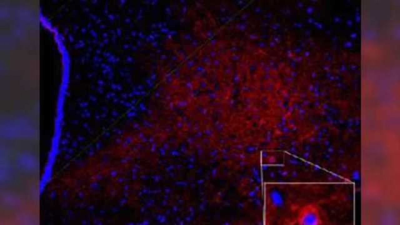 A broken calorie sensing pathway: How overeating may lead to more eating