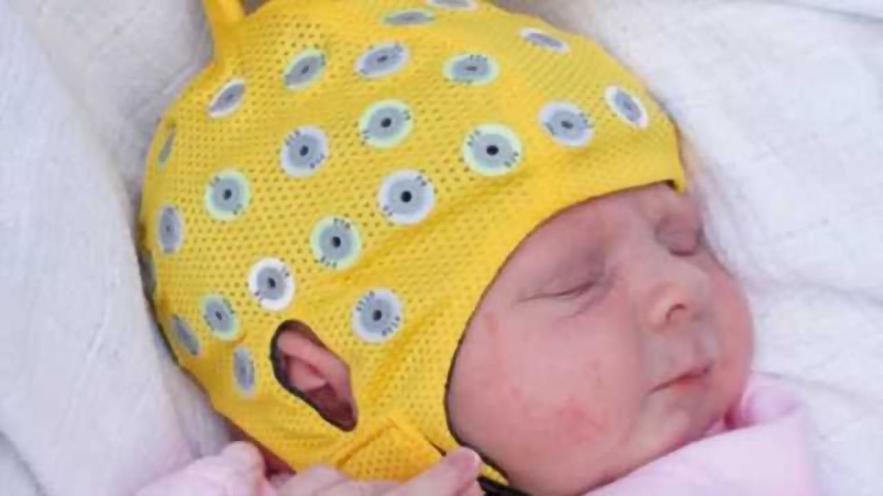 Antidepressive treatment during pregnancy can affect newborn brain activity