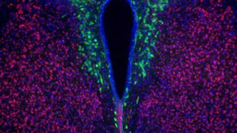 A single species of gut bacteria can reverse autism-related social behavior in mice