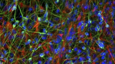 Gamma-ray irradiation improves safety of cell therapy for Parkinson's disease