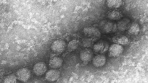 Researchers discover how West Nile virus triggers memory loss