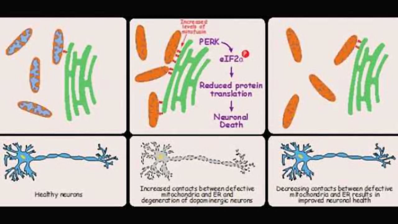 New findings challenge current view on origins of Parkinson's disease