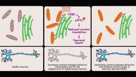 New findings challenge current view on origins of Parkinson's disease
