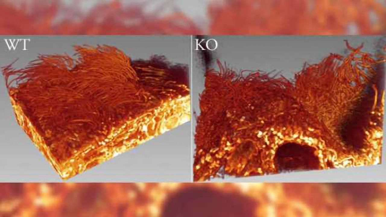 Loss of essential protein in the choroid plexus epithelium linked to hydrocephalus
