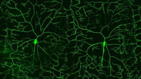 'Smoke alarm' one of 36 genes newly found to play role in pain sensation