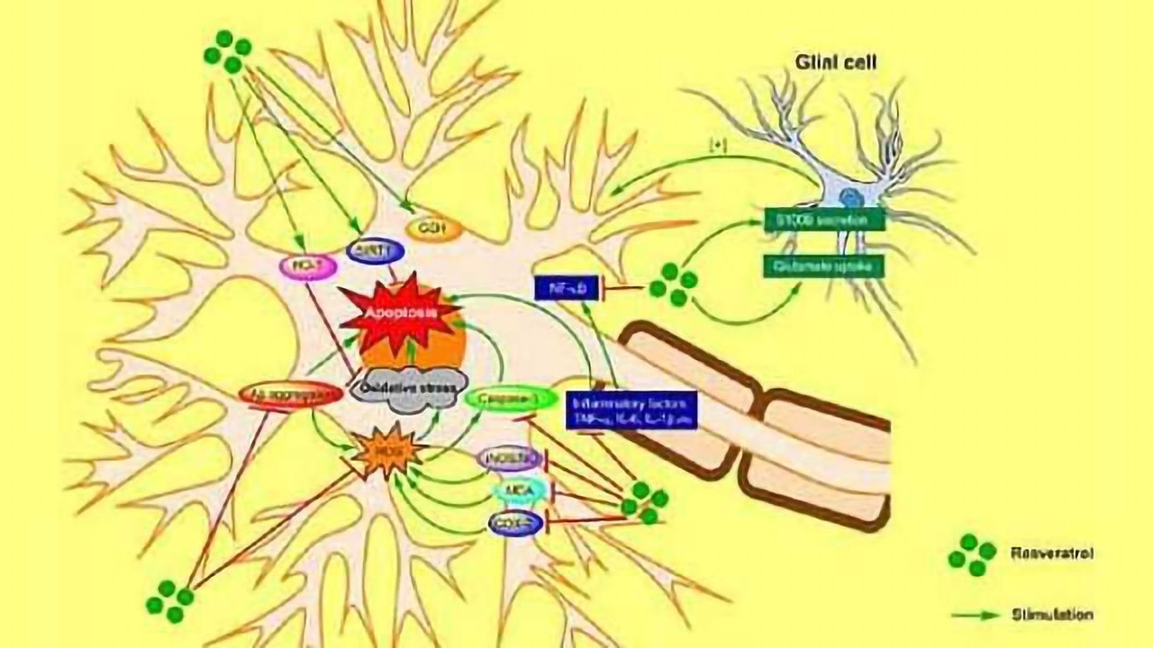 Combination therapy may hold the key to slowing down Alzheimer's disease