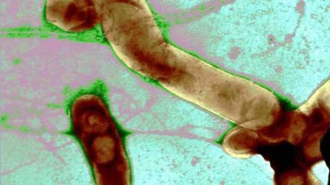 Researcher finds link between gut bacteria and multiple sclerosis