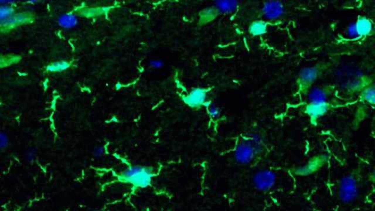 Disrupted immunity in the fetal brain is linked to neurodevelopmental disorders