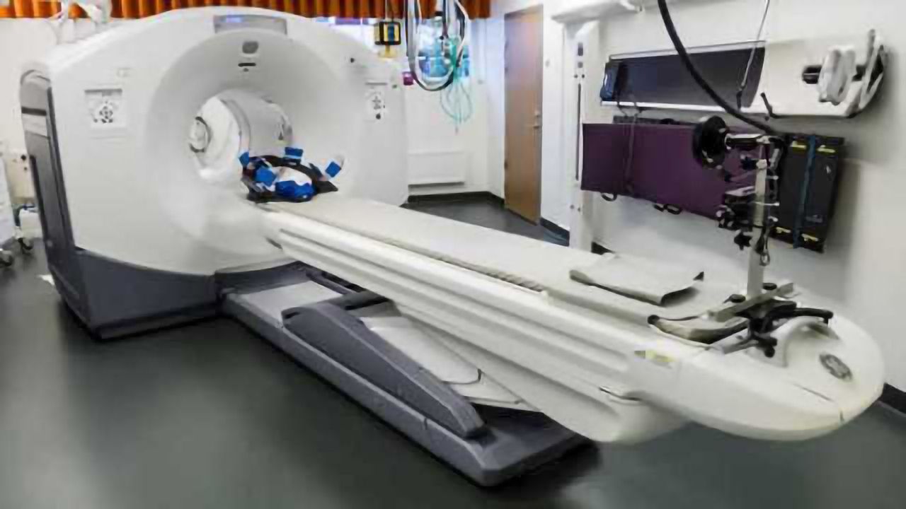 New clues about the aging brain's memory functions