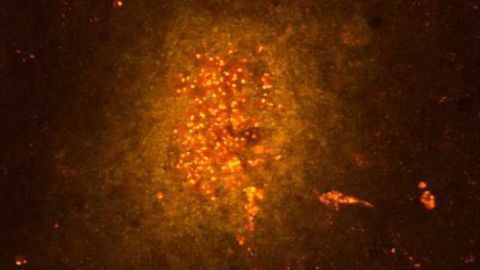Can anti-inflammatory therapies be effective against epilepsy?
