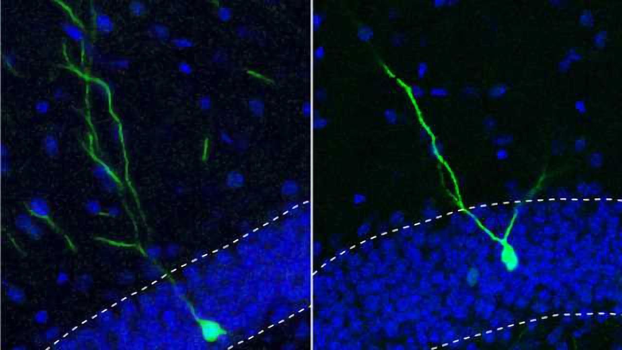 Small molecule keeps new adult neurons from straying, may be tied to schizophrenia
