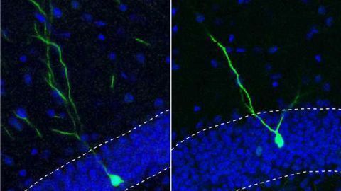 Small molecule keeps new adult neurons from straying, may be tied to schizophrenia