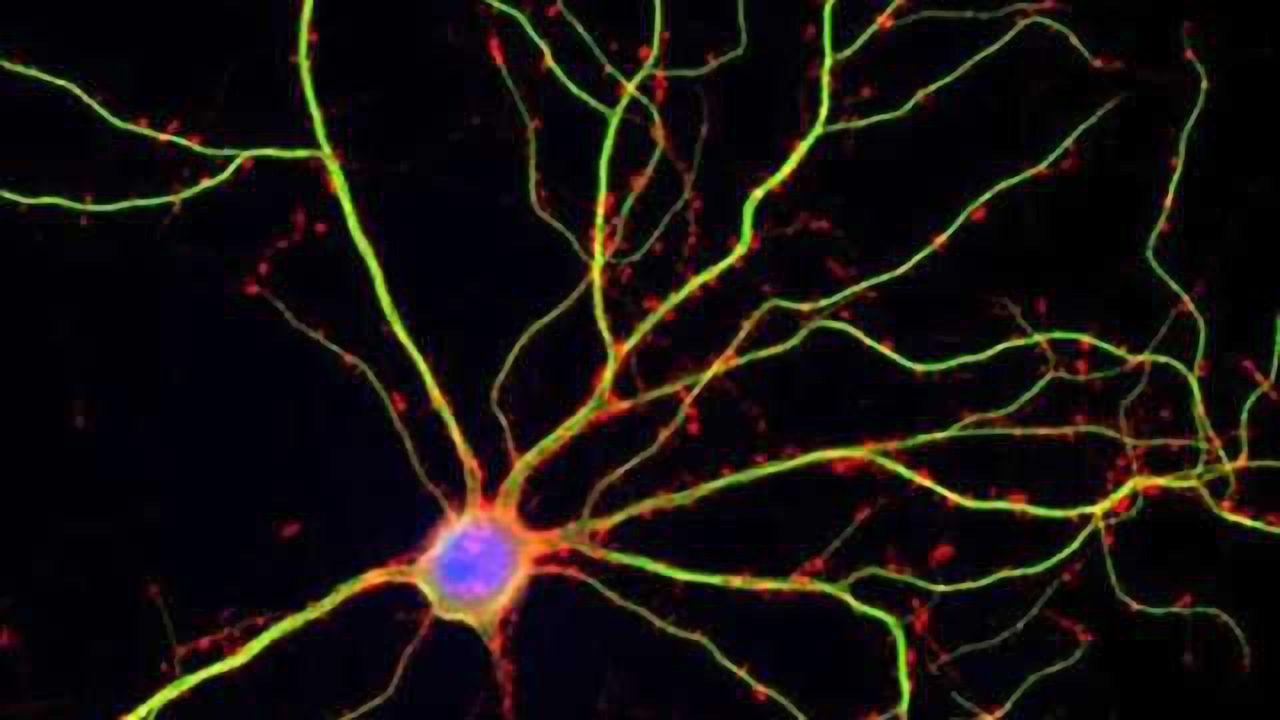 Sac to the future: Cellular vessels predict likelihood of developing dementia