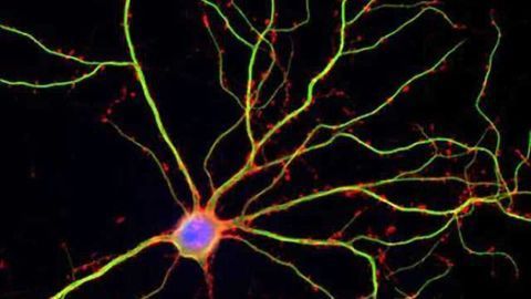 Sac to the future: Cellular vessels predict likelihood of developing dementia