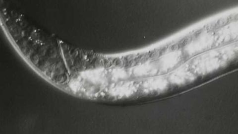 New clue to how lithium works in the brain