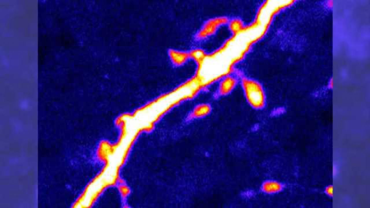 'Hunger' neurons in the brain are regulated by protein activated during fasting