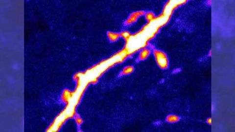 'Hunger' neurons in the brain are regulated by protein activated during fasting