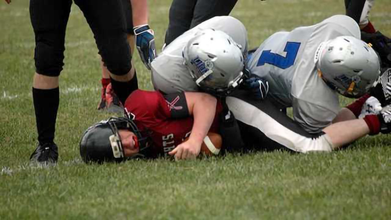 Athletes may have white matter brain changes 6 months after a concussion
