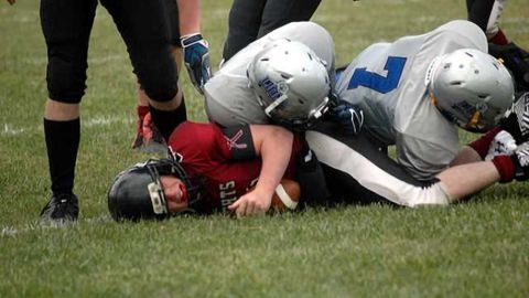 Athletes may have white matter brain changes 6 months after a concussion