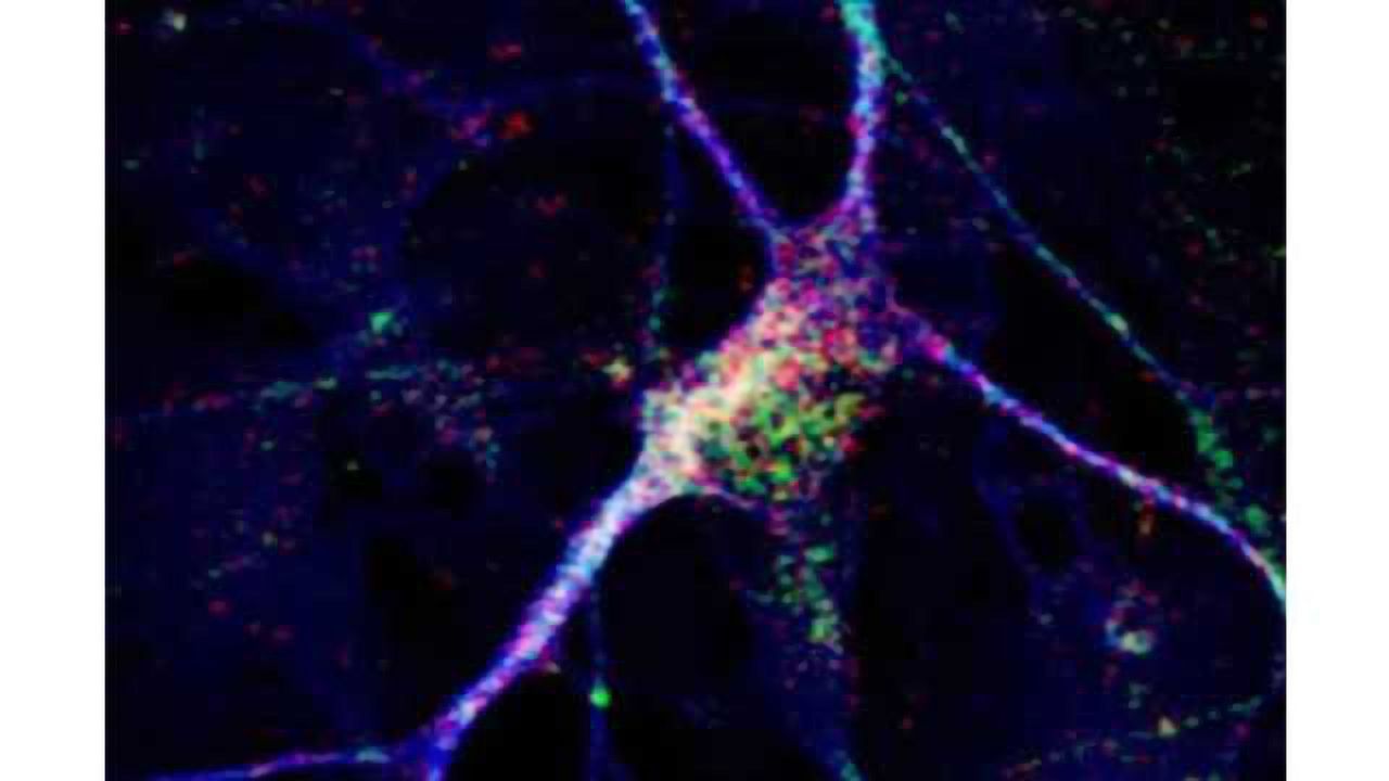 New neurons reveal clues about an individual's autism