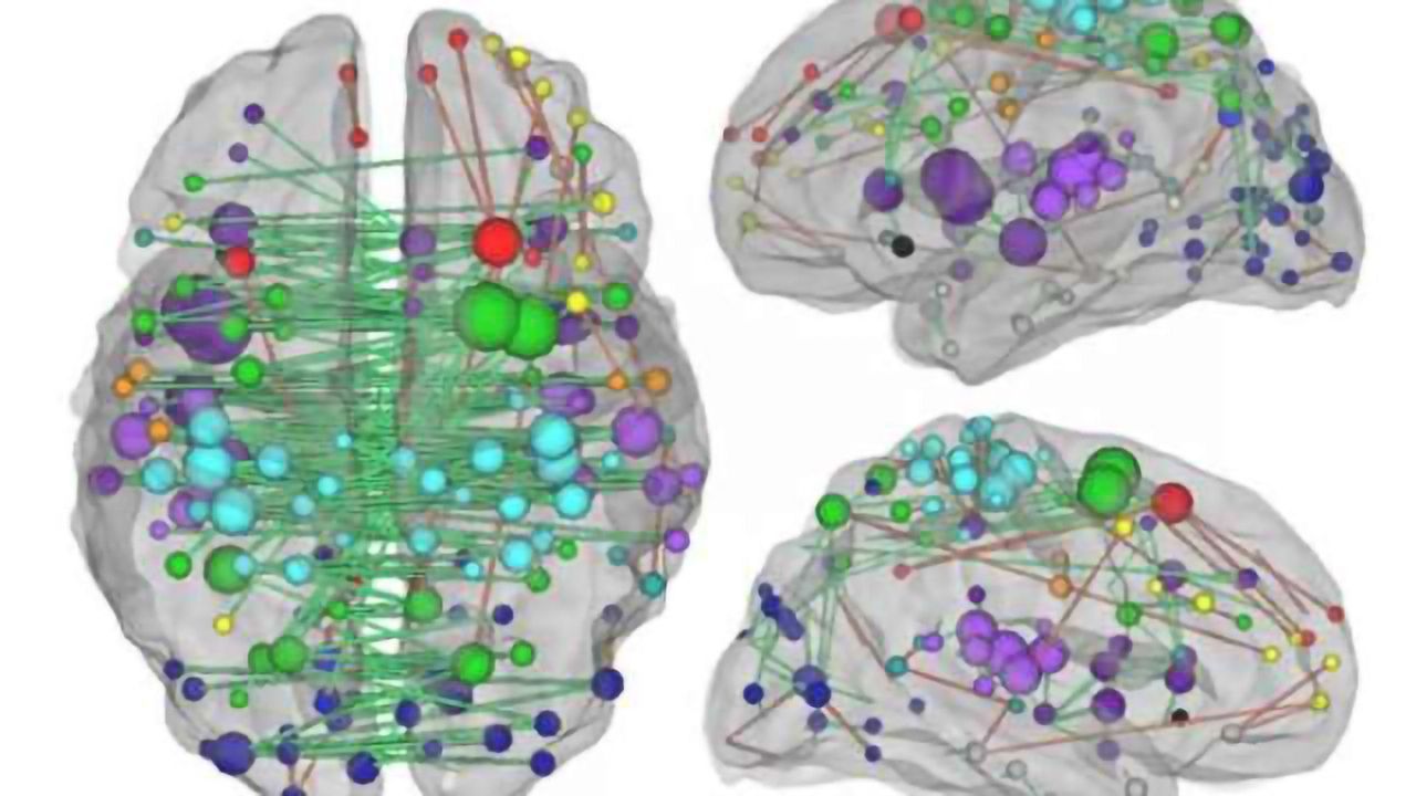 Measuring damage to brain networks may aid stroke treatment, predict recovery