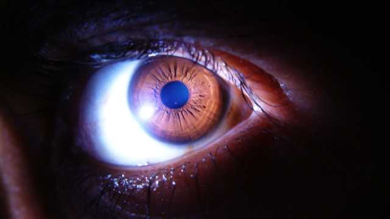 Alzheimer's detected before symptoms via new eye technology