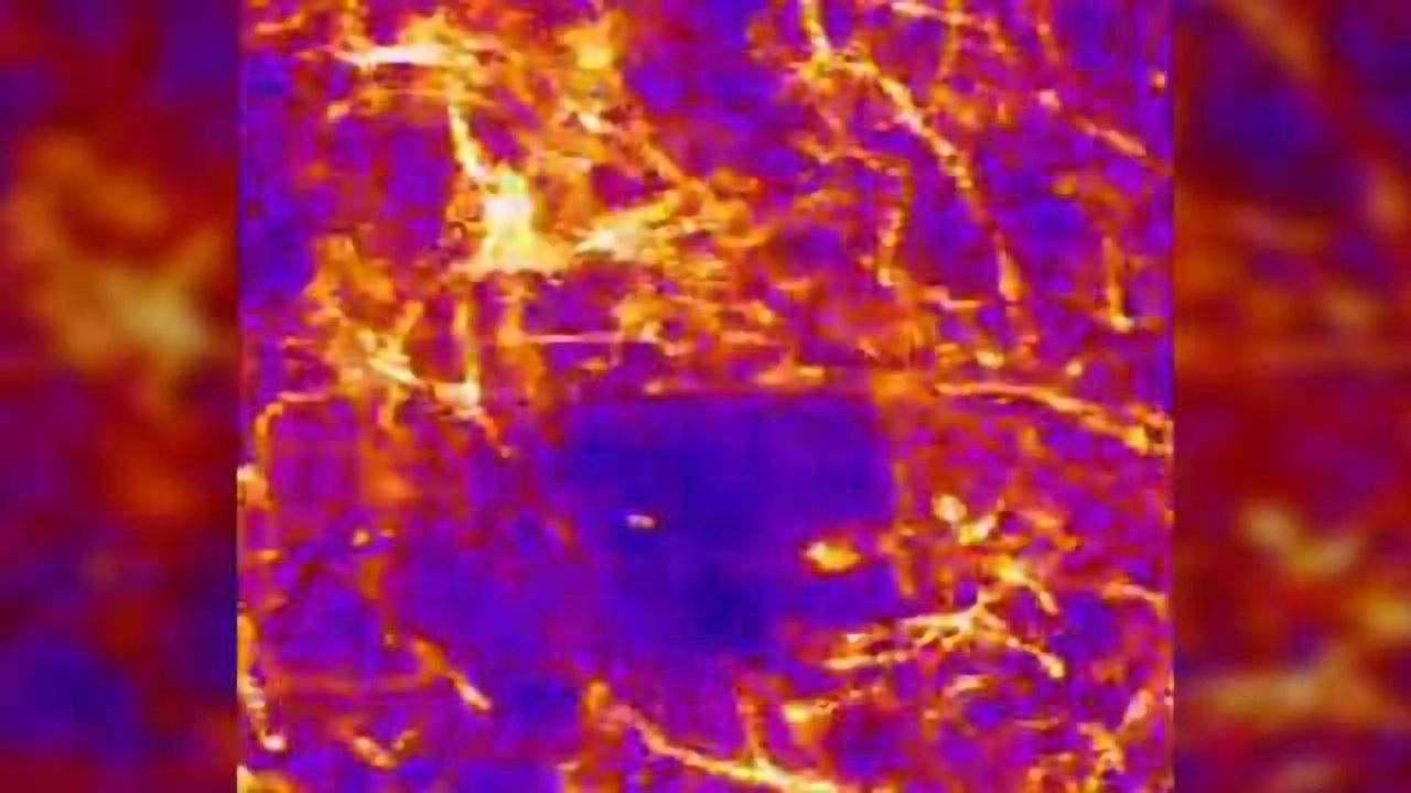 Scientists identify neurochemical signal likely missing in Parkinson's