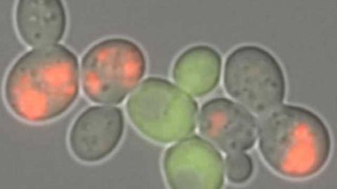 Shedding new light on protein aggregates and the diseases they cause