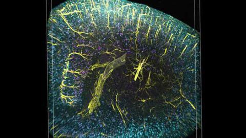 3-D imaging reveals unexpected arrangement of plaques in Alzheimer's-afflicted brains
