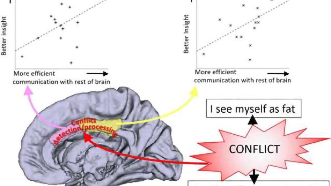 Abnormalities found in 'insight' areas of the brain in anorexia