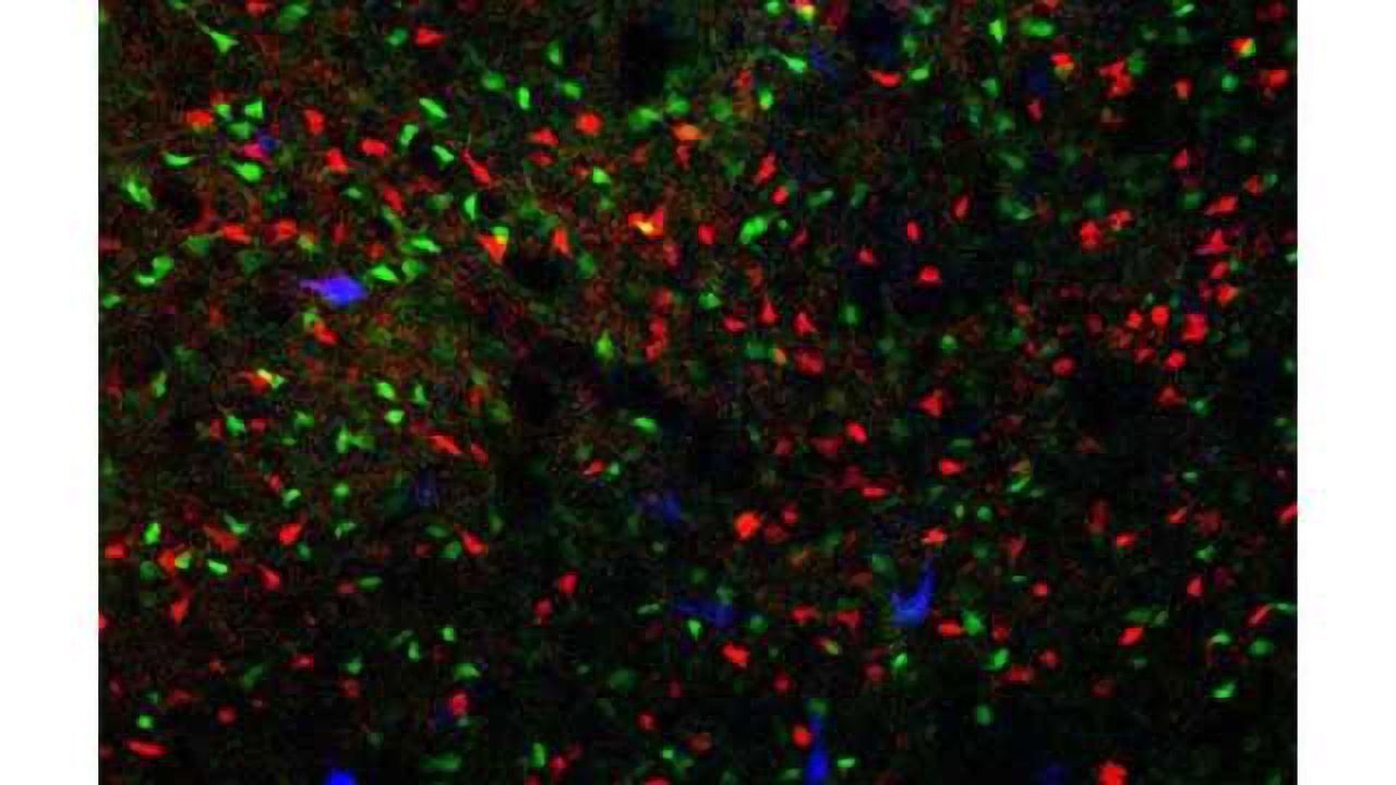 Study points to fast-acting drug for OCD