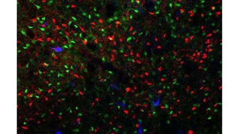 Study points to fast-acting drug for OCD