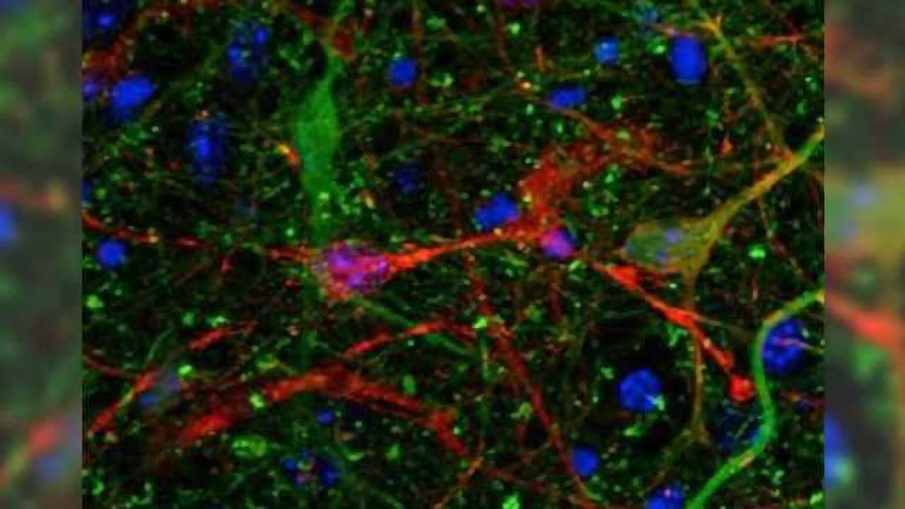 Toxic Alzheimer's protein spreads through brain via extracellular space