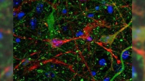 Toxic Alzheimer's protein spreads through brain via extracellular space