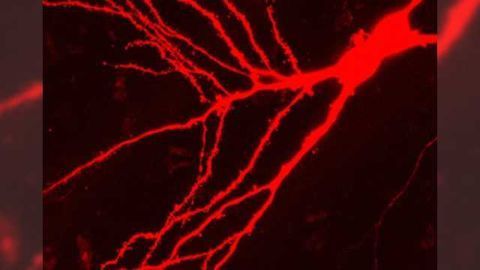 Novel compounds arrested epilepsy development in mice